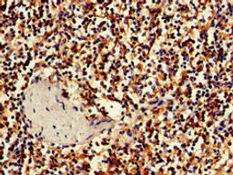 Immunohistochemistry of paraffin-embedded human spleen tissue using CSB-PA845172LA01HU at dilution of 1:100