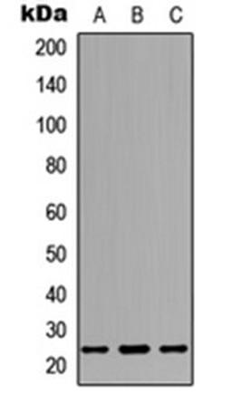 Western blot analysis of SHSY5Y (Lane 1), NS-1 (Lane 2), PC12 (Lane 3) whole cell lysates using Dectin 2 antibody