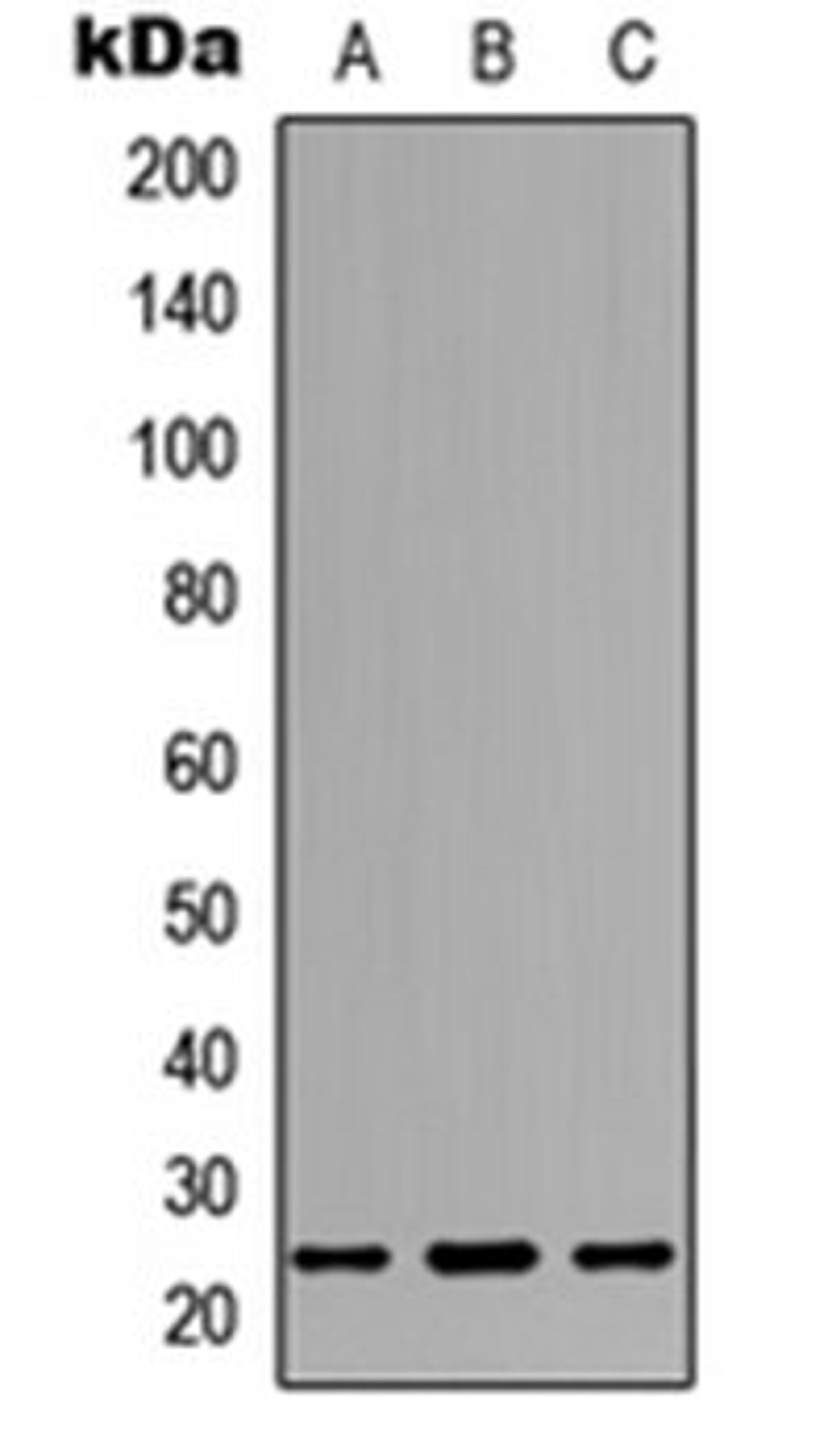 Western blot analysis of SHSY5Y (Lane 1), NS-1 (Lane 2), PC12 (Lane 3) whole cell lysates using Dectin 2 antibody