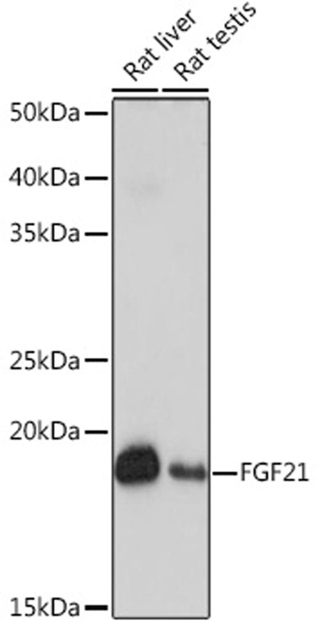 Western blot - FGF21 Rabbit mAb (A3908)