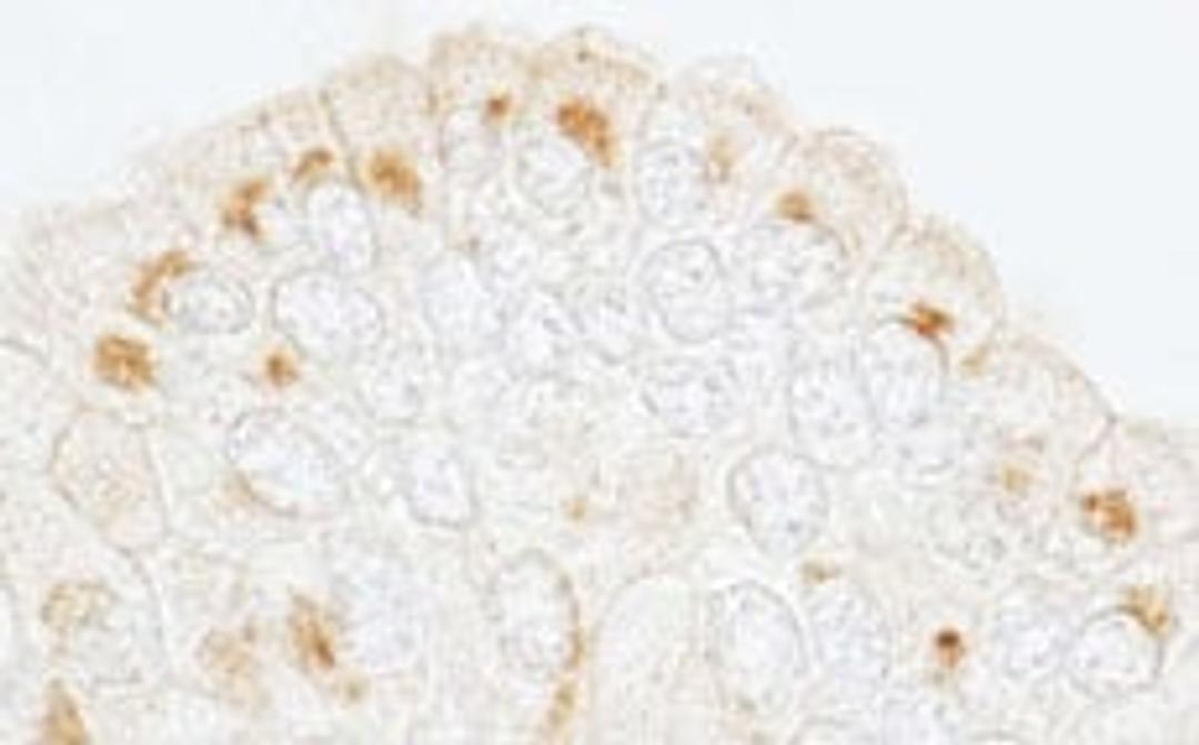 Detection of human GBF1 by immunohistochemistry.