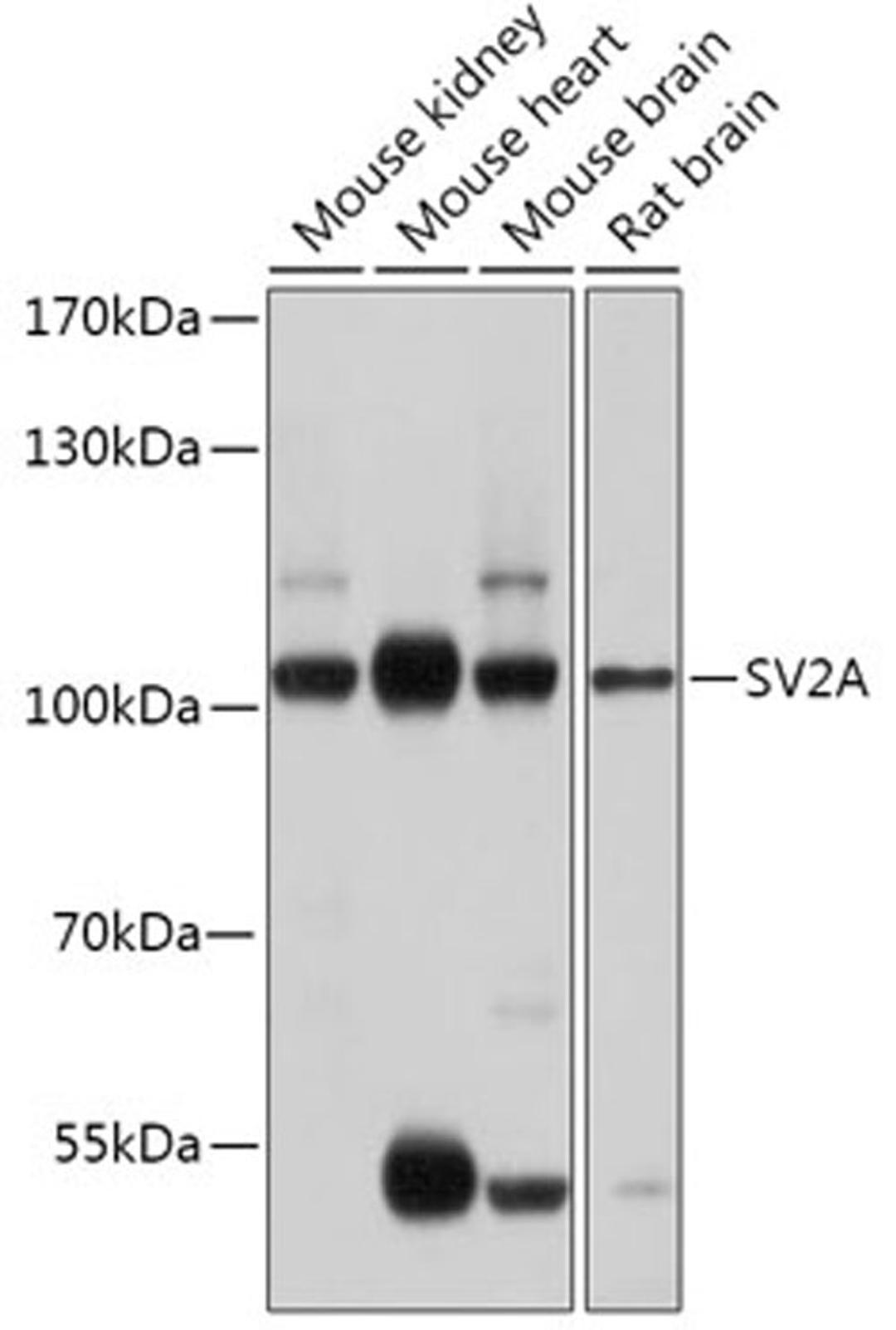 Western blot - SV2A antibody (A17868)