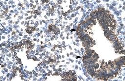 Antibody used in IHC on Human Lung lysate.