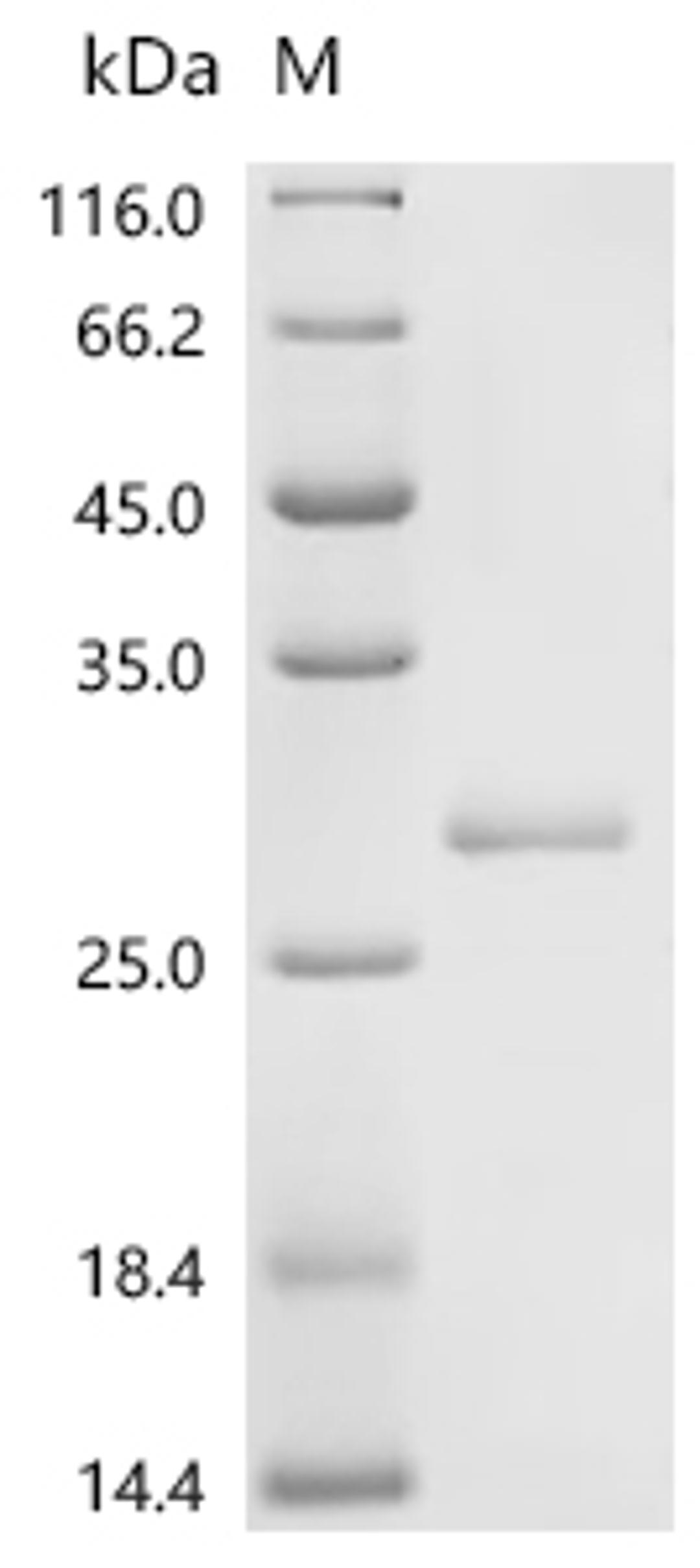 (Tris-Glycine gel) Discontinuous SDS-PAGE (reduced) with 5% enrichment gel and 15% separation gel.
