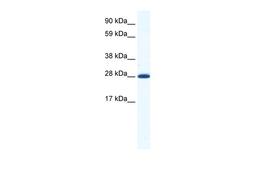 Antibody used in WB on Mouse NIH-3T3 at 1.25 ug/ml.