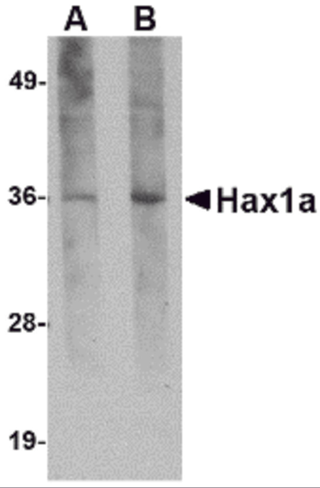 Western blot analysis of Hax1a in human brain tissue lysate with Hax1a antibody at (A) 1 and (B) 2 &#956;g/mL.