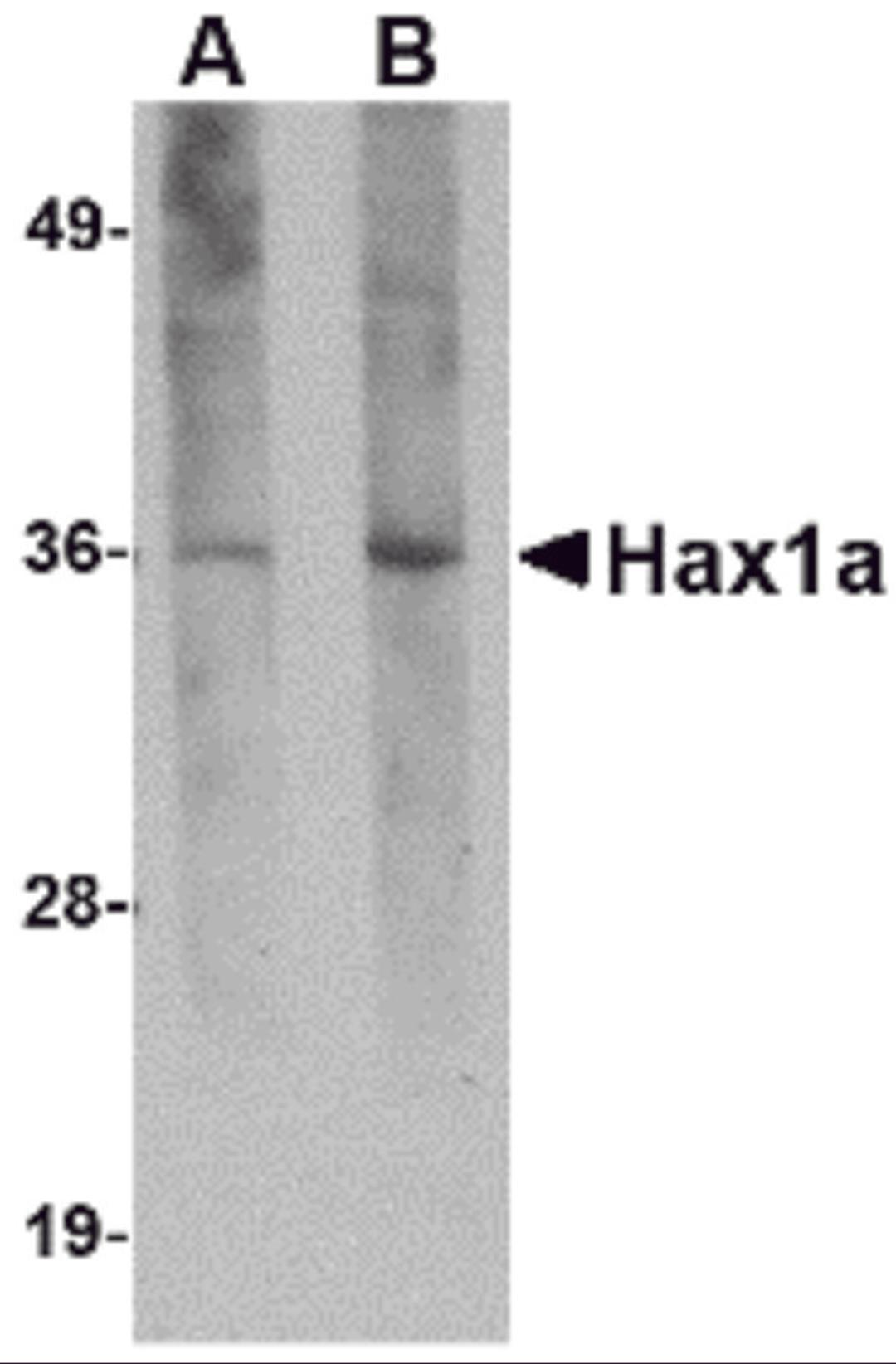 Western blot analysis of Hax1a in human brain tissue lysate with Hax1a antibody at (A) 1 and (B) 2 μg/mL.