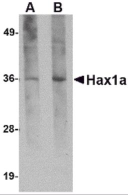 Western blot analysis of Hax1a in human brain tissue lysate with Hax1a antibody at (A) 1 and (B) 2 μg/mL.