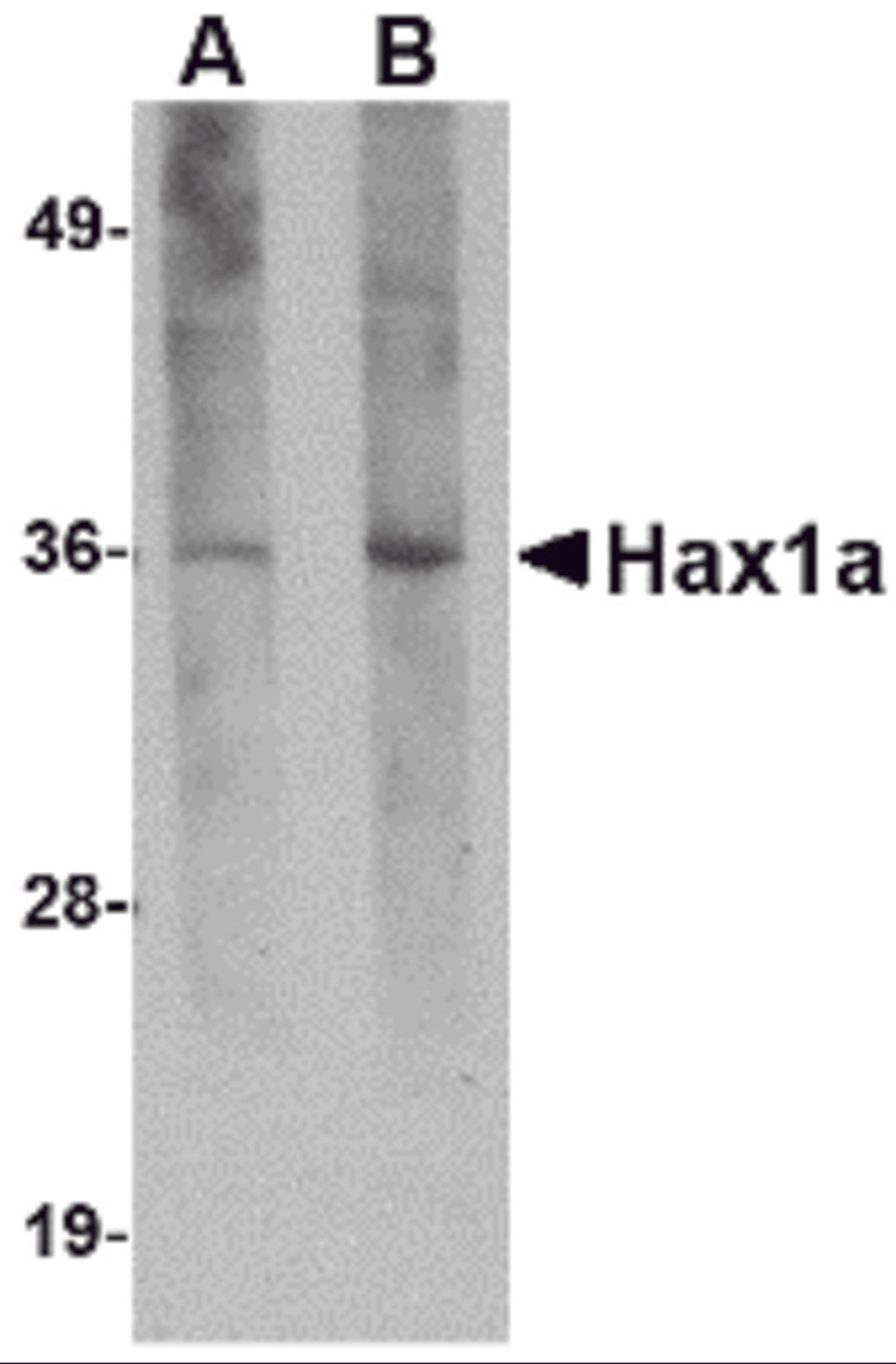 Western blot analysis of Hax1a in human brain tissue lysate with Hax1a antibody at (A) 1 and (B) 2 μg/mL.