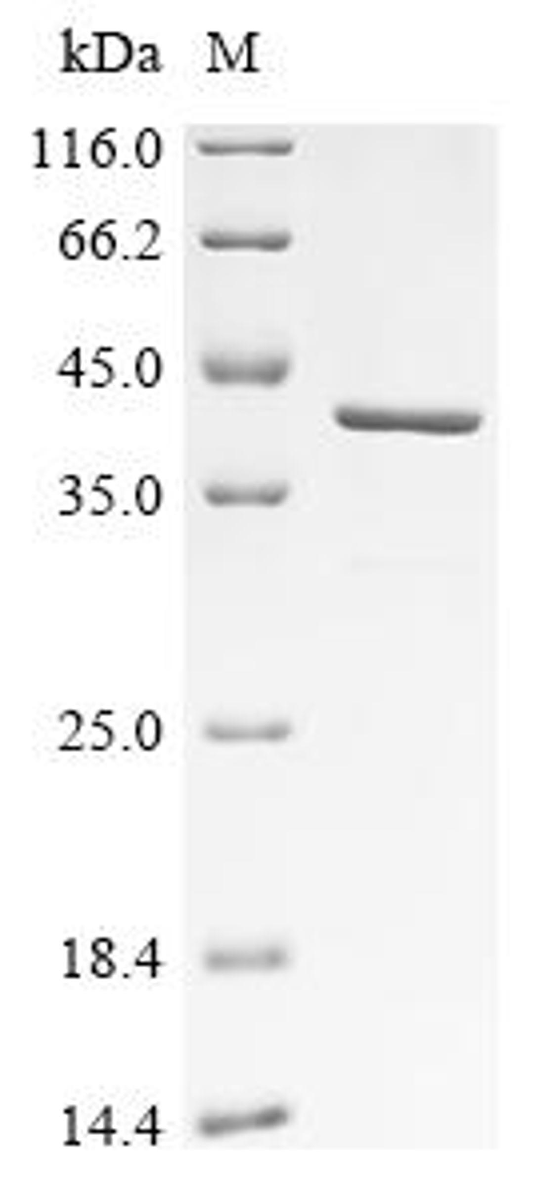 (Tris-Glycine gel) Discontinuous SDS-PAGE (reduced) with 5% enrichment gel and 15% separation gel.