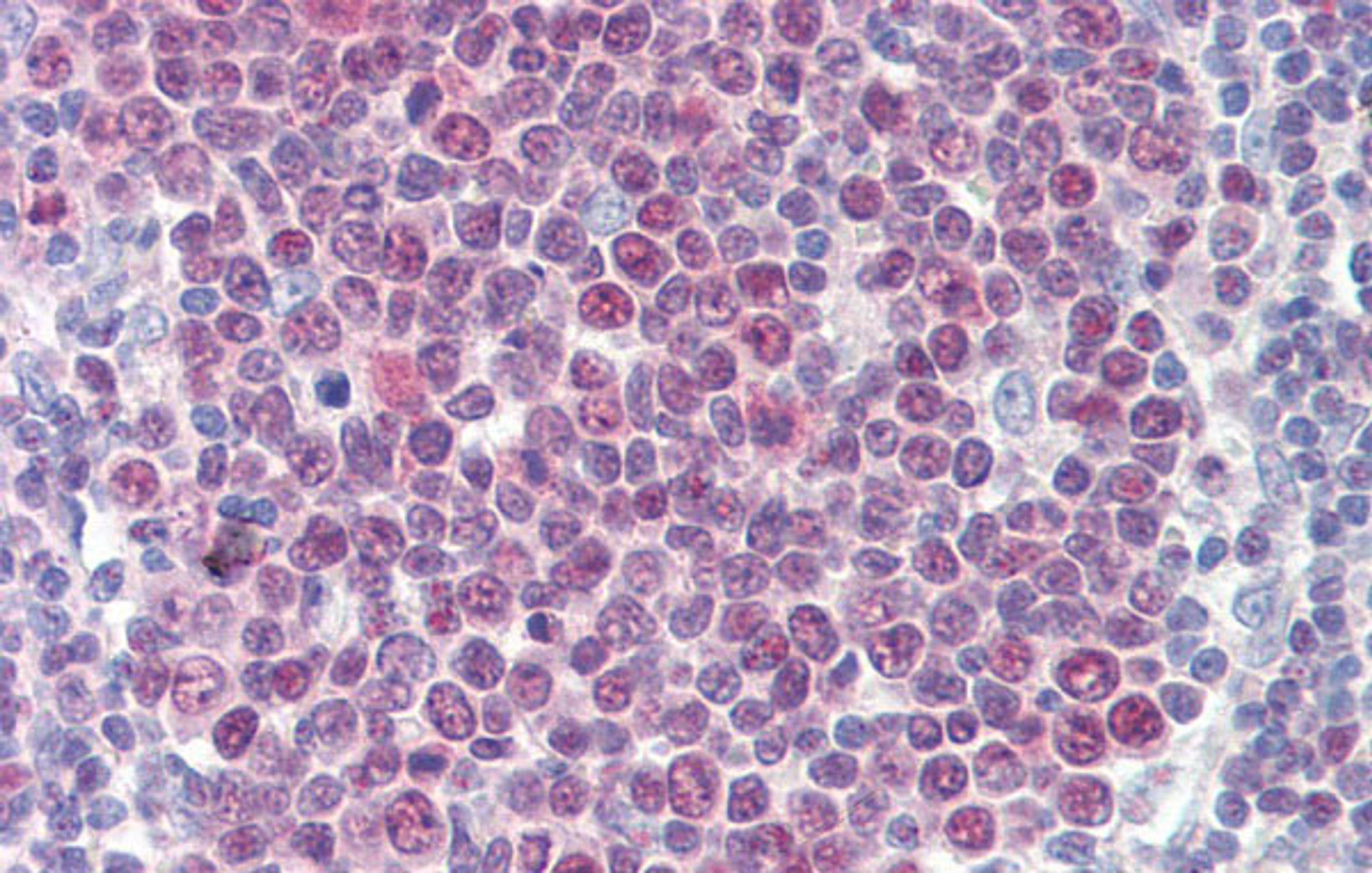 Antibody used in IHC on Human Tonsil at 5.0 ug/ml.