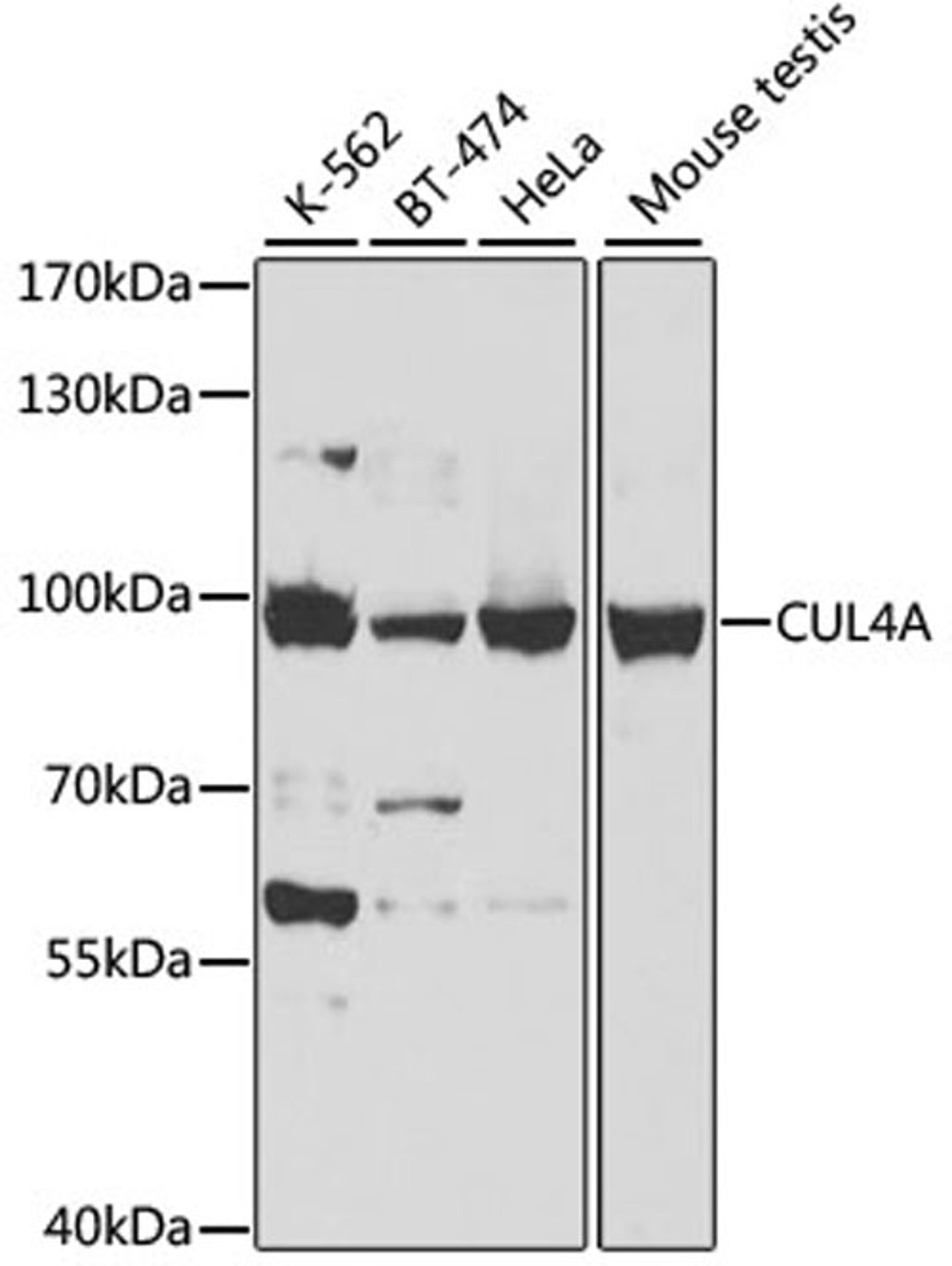 Western blot - CUL4A antibody (A2882)