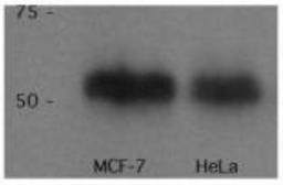 Western Blot: p53 Antibody (PAb 240) [NB200-103] - WB analysis of p53 in MCF7 and HeLa lystates. Image courtesy of anonymous customer product review.