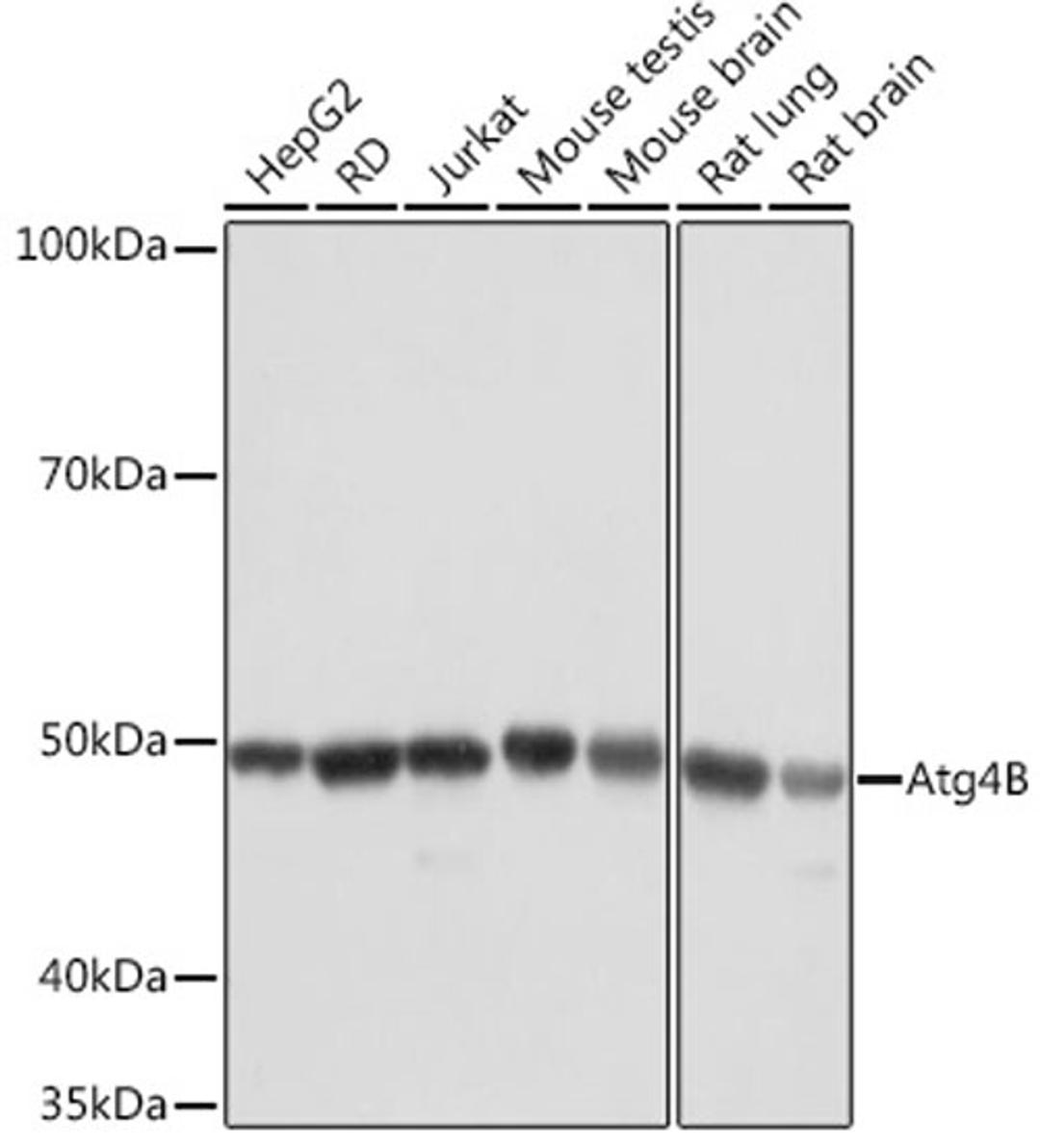 Western blot - Atg4B Rabbit mAb (A5059)