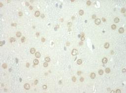 Detection of human WDFY3 by immunohistochemistry.