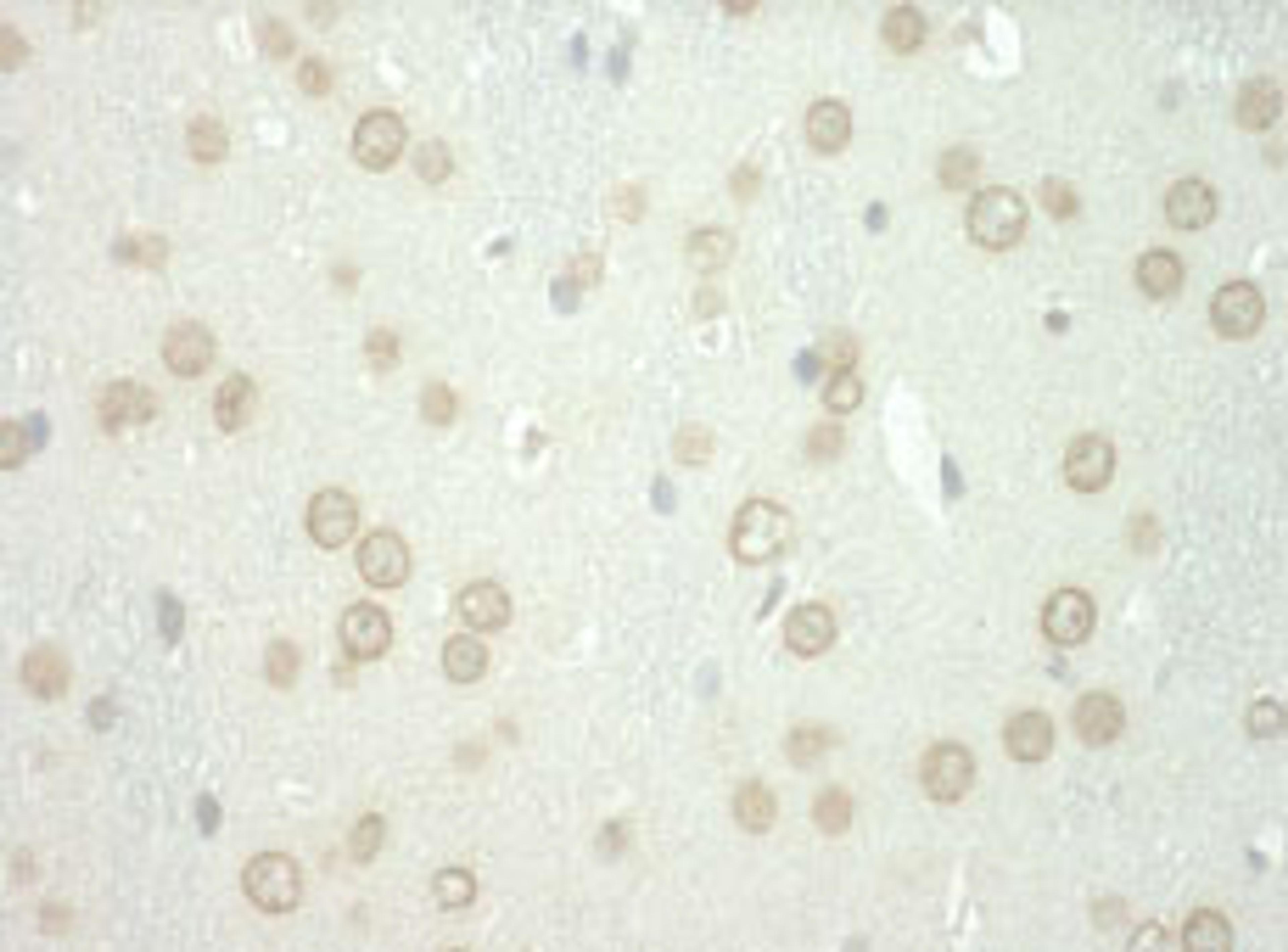 Detection of human WDFY3 by immunohistochemistry.