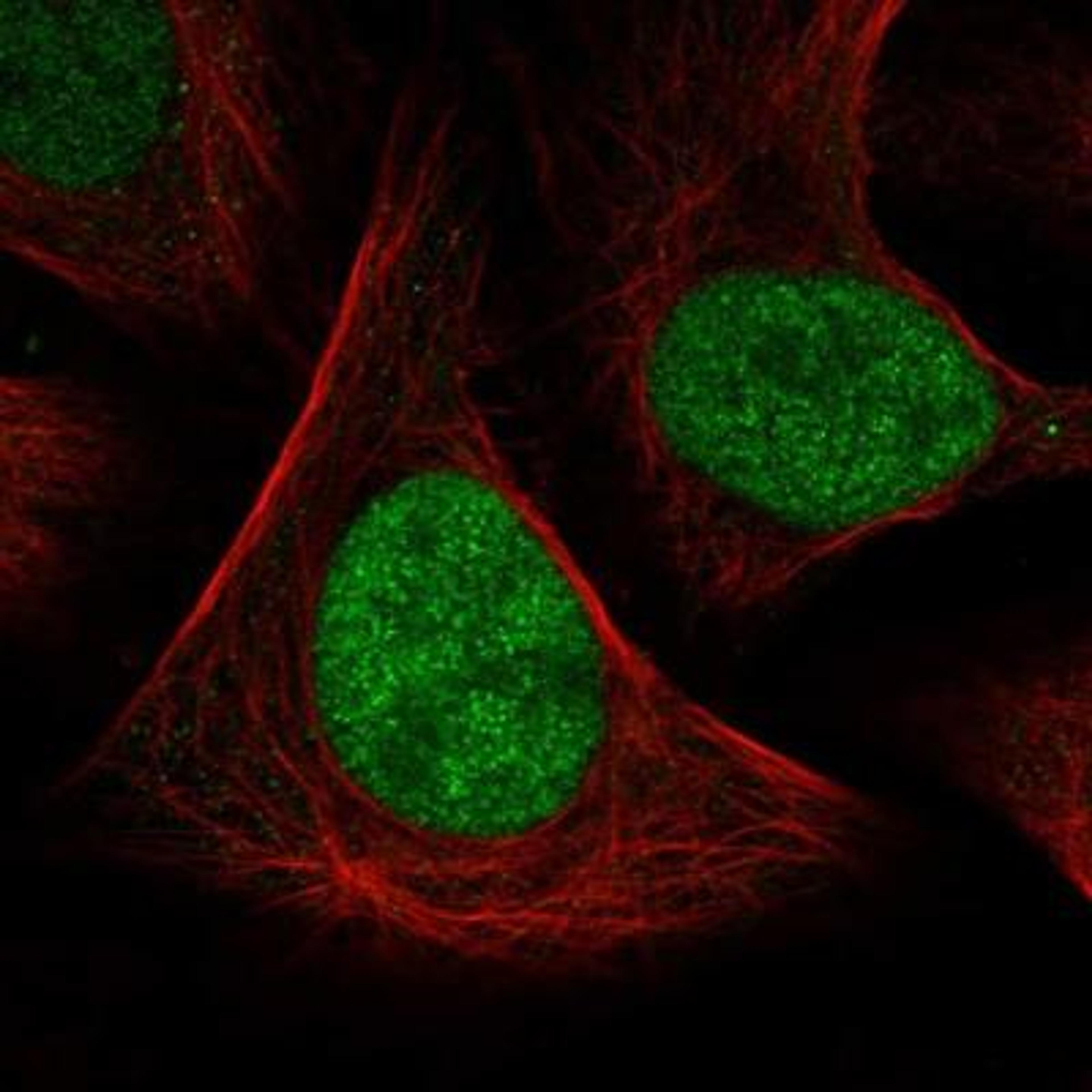 Immunocytochemistry/Immunofluorescence: HP1BP3 Antibody [NBP1-83229] - Staining of human cell line U-2 OS shows positivity in nucleus but not nucleoli.