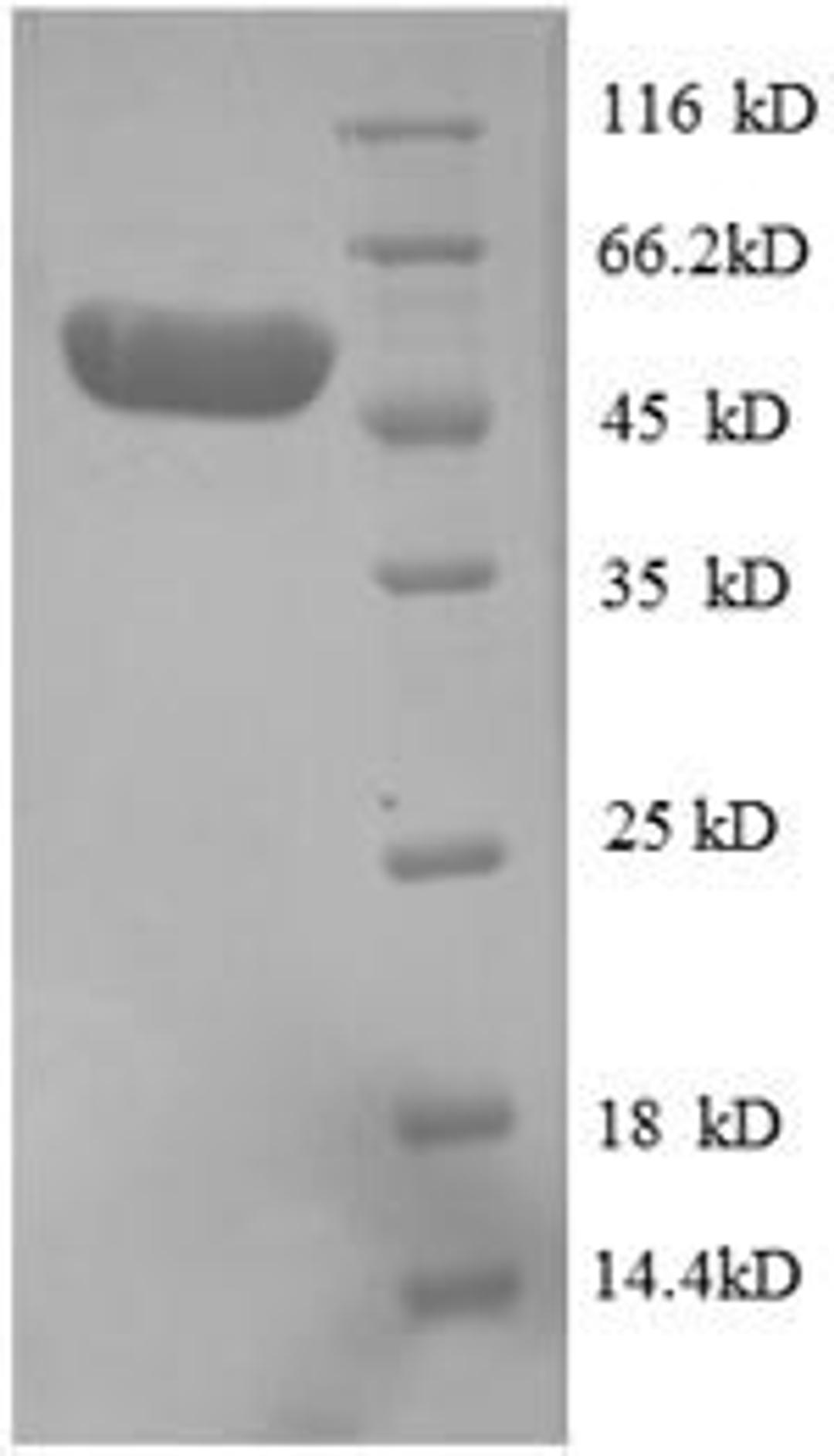 (Tris-Glycine gel) Discontinuous SDS-PAGE (reduced) with 5% enrichment gel and 15% separation gel.