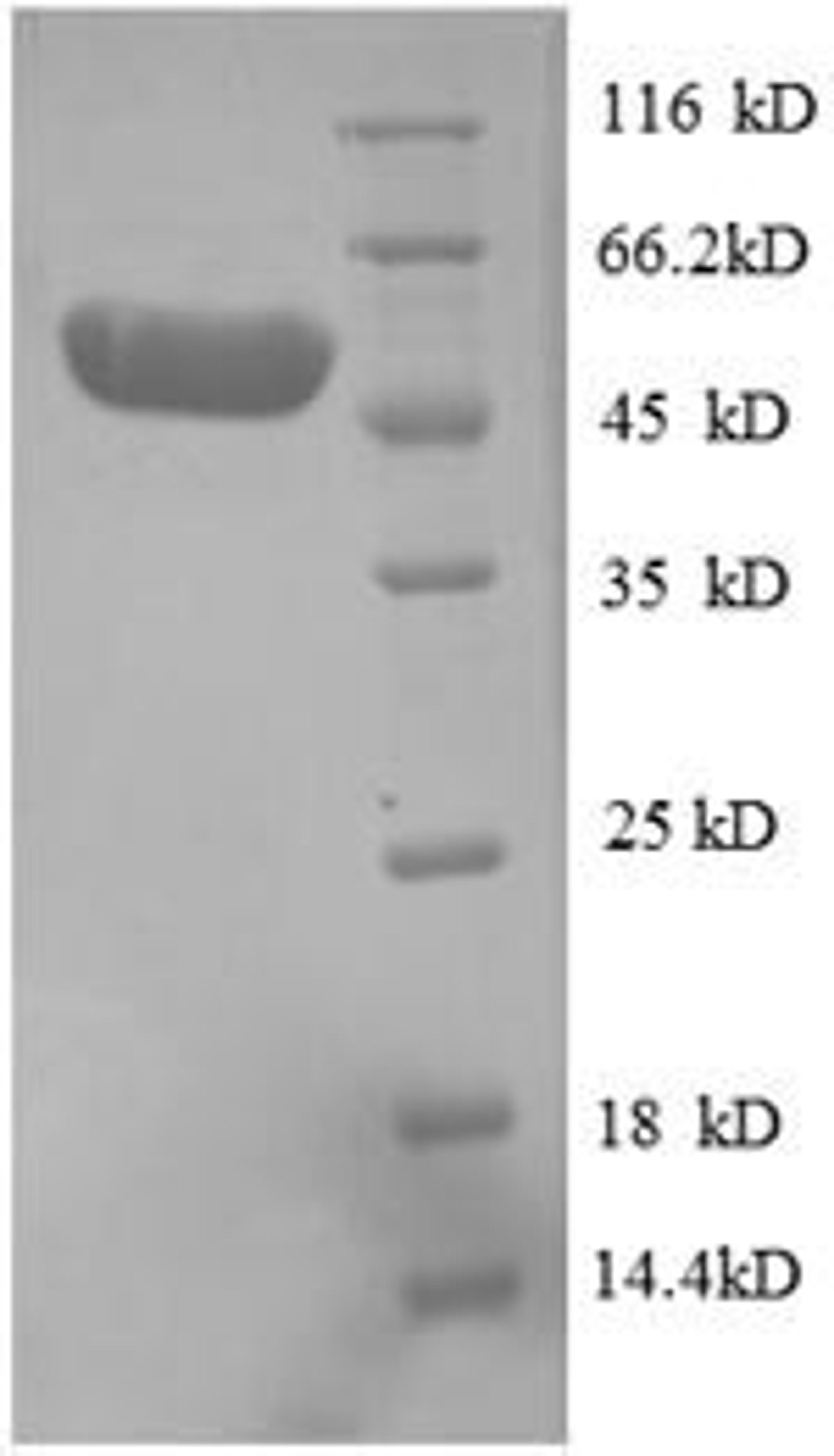 (Tris-Glycine gel) Discontinuous SDS-PAGE (reduced) with 5% enrichment gel and 15% separation gel.