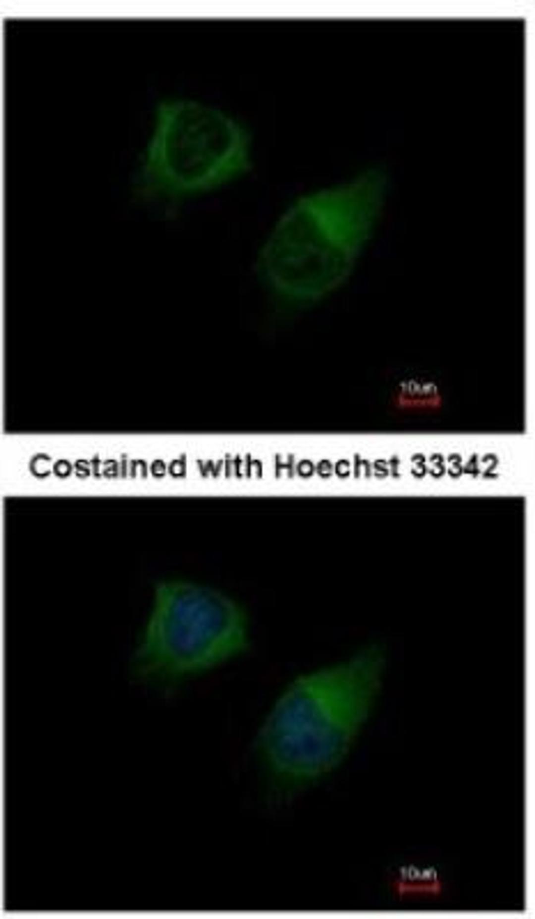 Immunocytochemistry/Immunofluorescence: DGK-gamma Antibody [NBP1-33055] - Analysis of methanol-fixed HeLa, using antibody at 1:200 dilution.