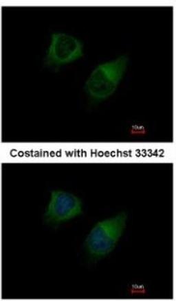 Immunocytochemistry/Immunofluorescence: DGK-gamma Antibody [NBP1-33055] - Analysis of methanol-fixed HeLa, using antibody at 1:200 dilution.