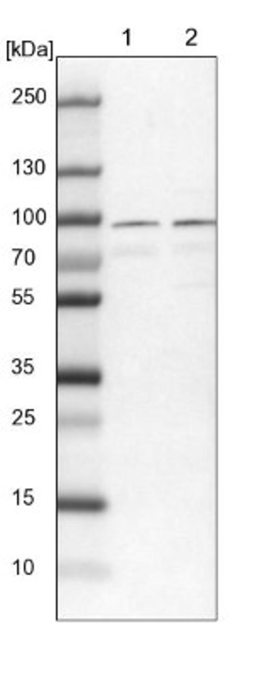 Western Blot: RUFY1 Antibody [NBP1-83606] - Lane 1: NIH-3T3 cell lysate (Mouse embryonic fibroblast cells)<br/>Lane 2: NBT-II cell lysate (Rat Wistar bladder tumour cells)