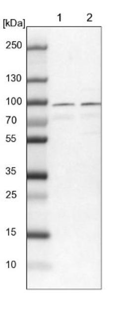 Western Blot: RUFY1 Antibody [NBP1-83606] - Lane 1: NIH-3T3 cell lysate (Mouse embryonic fibroblast cells)<br/>Lane 2: NBT-II cell lysate (Rat Wistar bladder tumour cells)