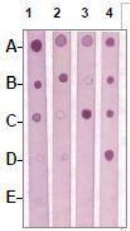 Dot Blot: RON [p Tyr1238, p Tyr1239] Antibody [NBP1-74680] - RON [p Tyr1238, p Tyr1239] Antibody 1 mg peptide was blot onto NC membrane: A: CD136 (pY1238/Y1239) / B: CD136(pY1238) / C: CD136 (pY1239) / D: CD136 (Nonphospho) / E: Non-related Phosphopeptide) were blotted at a 1:2000 dilution by: 1: Rabbit anti-CD136 (pY1238/Y1239) / 2: Rabbit anti-CD136 (pY1238) / 3: Rabbit anti-CD136 (pY1239) / 4: Rabbit anti-CD136