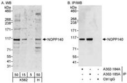 Detection of human NOPP140 by western blot and immunoprecipitation.