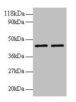Western blot. All lanes: B4GALT3 antibody at 2µg/ml. Lane 1: EC109 whole cell lysate. Lane 2: 293T whole cell lysate. Secondary. Goat polyclonal to rabbit IgG at 1/15000 dilution. Predicted band size: 44, 16 kDa. Observed band size: 44 kDa