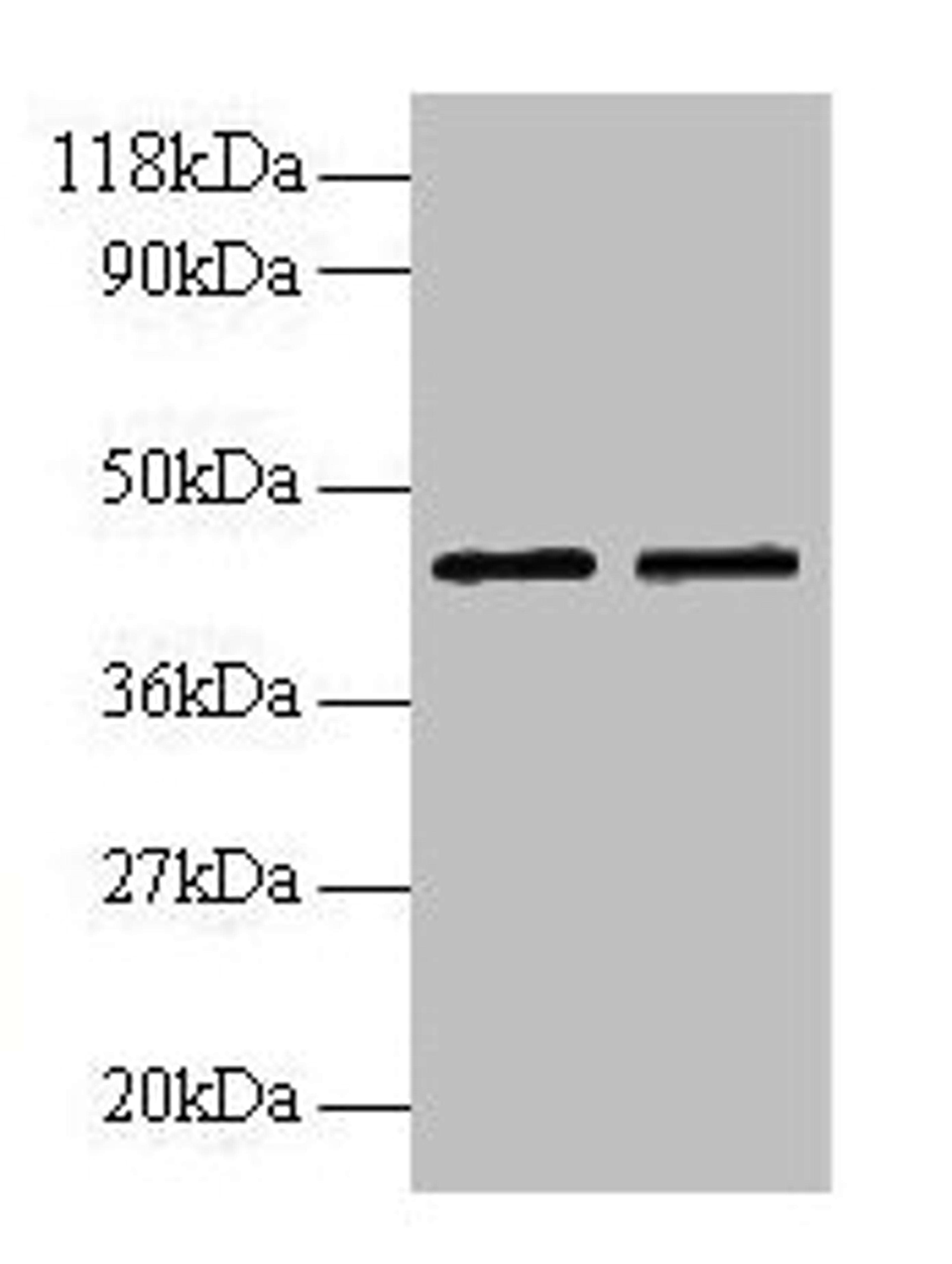 Western blot. All lanes: B4GALT3 antibody at 2µg/ml. Lane 1: EC109 whole cell lysate. Lane 2: 293T whole cell lysate. Secondary. Goat polyclonal to rabbit IgG at 1/15000 dilution. Predicted band size: 44, 16 kDa. Observed band size: 44 kDa