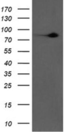 Western Blot: Factor XIIIa Antibody (6F5) [NBP2-45562] - Analysis of HEK293T cells were transfected with the pCMV6-ENTRY control (Left lane) or pCMV6-ENTRY Factor XIIa.