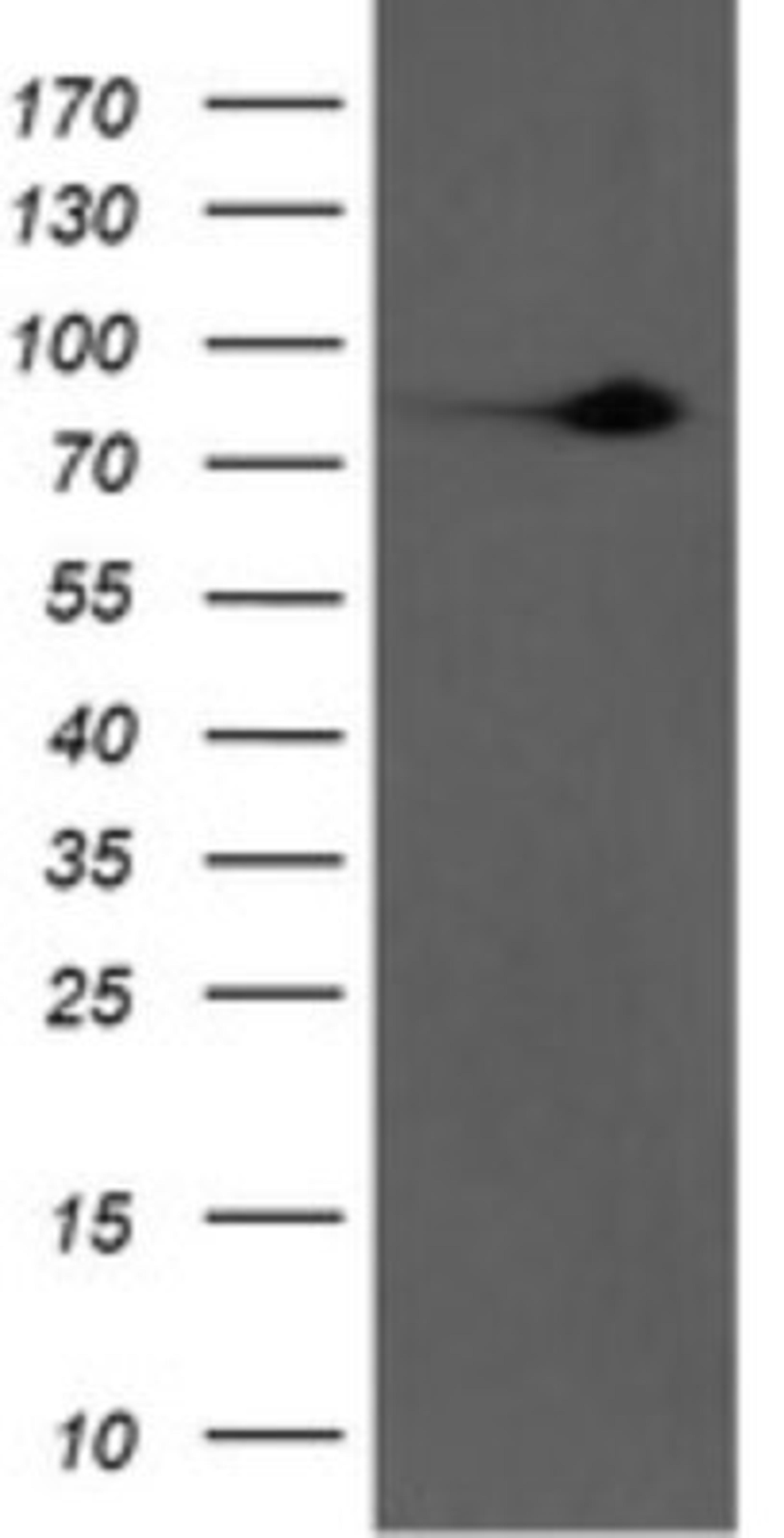 Western Blot: Factor XIIIa Antibody (6F5) [NBP2-45562] - Analysis of HEK293T cells were transfected with the pCMV6-ENTRY control (Left lane) or pCMV6-ENTRY Factor XIIa.