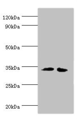 Western blot. All lanes: RPH3AL antibody at 12ug/ml. Lane 1: LO2 whole cell lysate. Lane 2: K562 whole cell lysate. Secondary. Goat polyclonal to rabbit IgG at 1/10000 dilution. Predicted band size: 35, 32 kDa. Observed band size: 35 kDa.