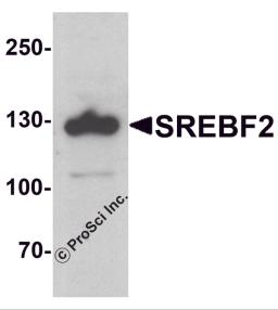 Western blot analysis of SREBF2 in PC-3 cell lysate with SREBF1 antibody at 1 &#956;g/ml.