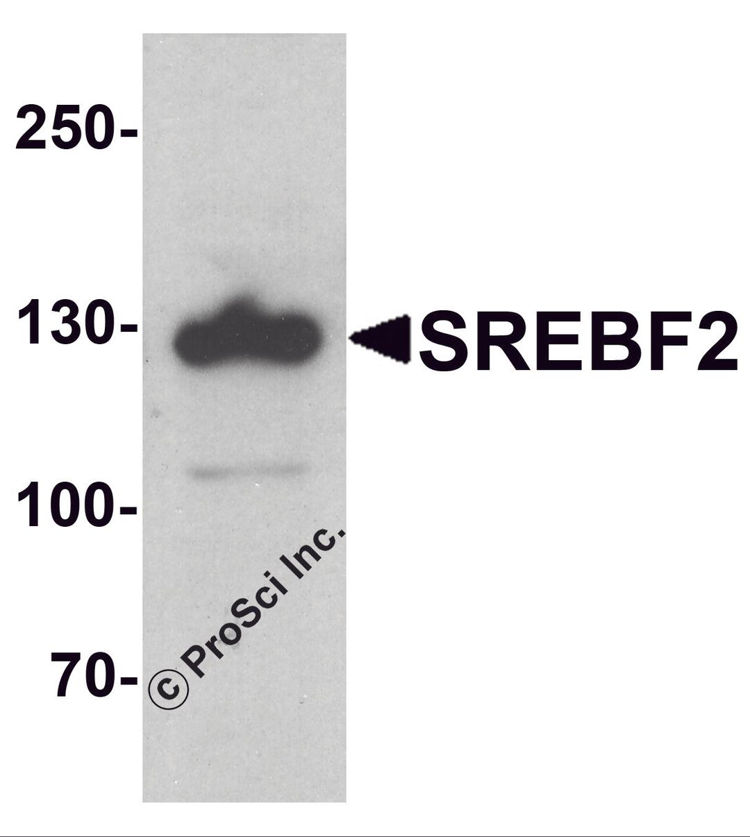 Western blot analysis of SREBF2 in PC-3 cell lysate with SREBF1 antibody at 1 μg/ml.
