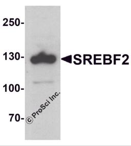 Western blot analysis of SREBF2 in PC-3 cell lysate with SREBF1 antibody at 1 μg/ml.
