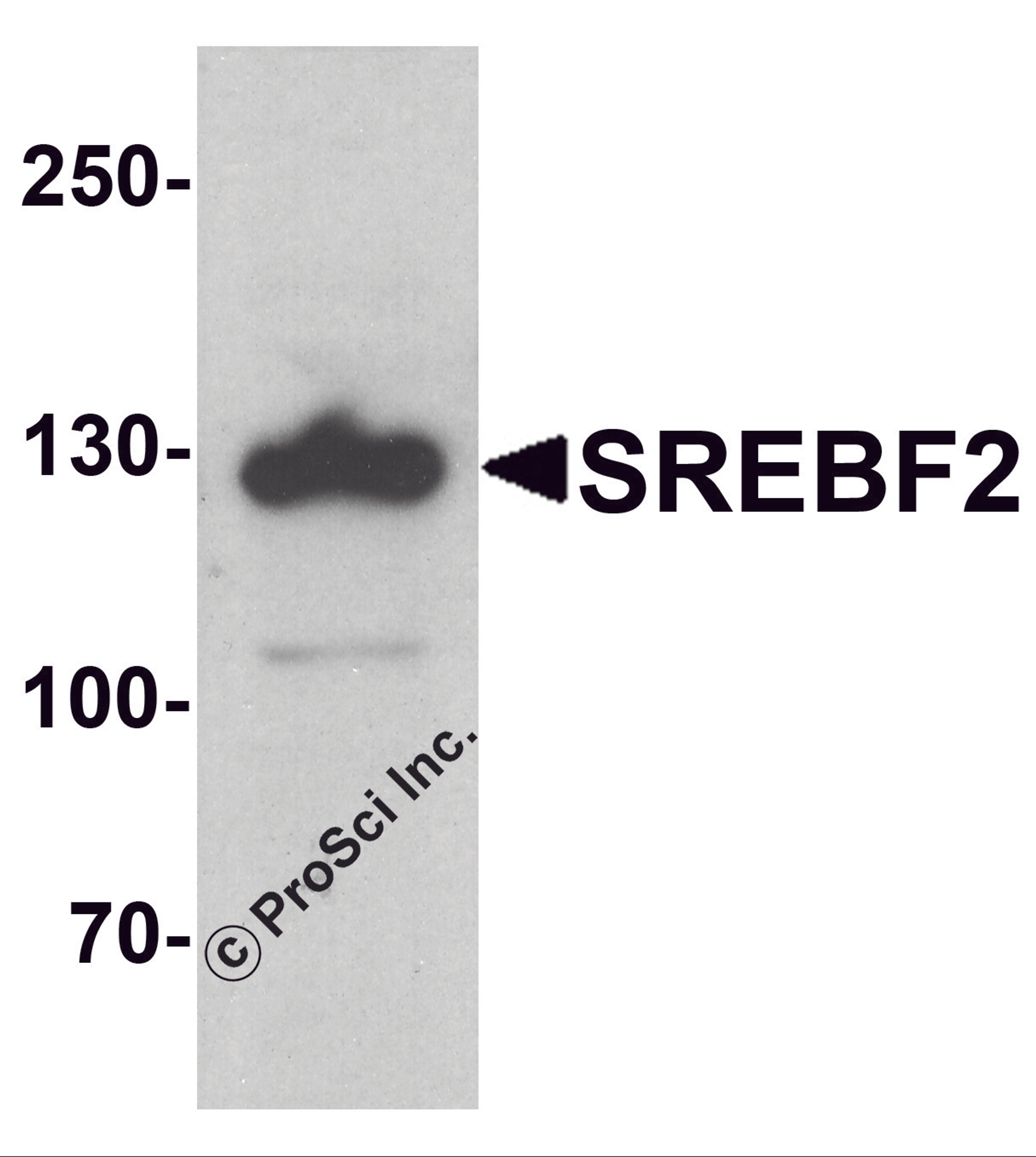 Western blot analysis of SREBF2 in PC-3 cell lysate with SREBF1 antibody at 1 μg/ml.
