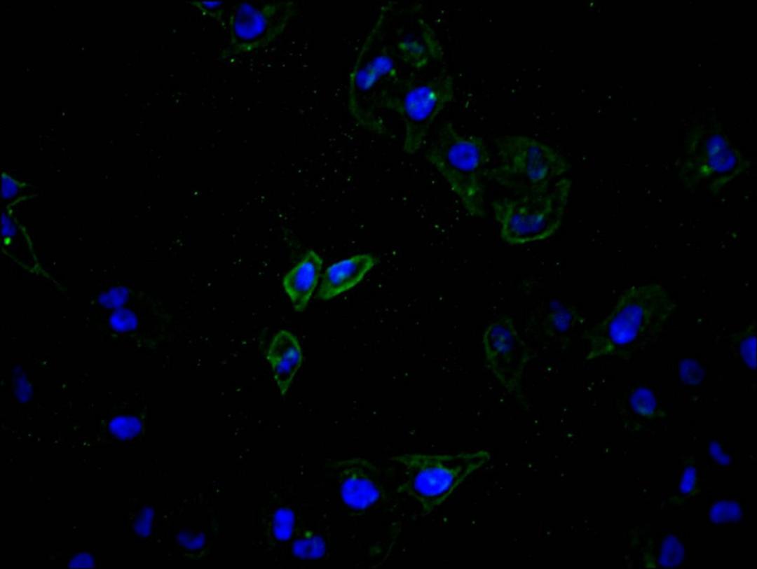 Immunofluorescence staining of Hela cell with CSB-RA002415MA1HU at 1:100, counter-stained with DAPI. The cells were fixed in 4% formaldehyde and blocked in 10% normal Goat Serum. The cells were then incubated with the antibody overnight at 4C. The secondary antibody was Alexa Fluor 488-congugated AffiniPure Goat Anti-Rabbit IgG(H+L).