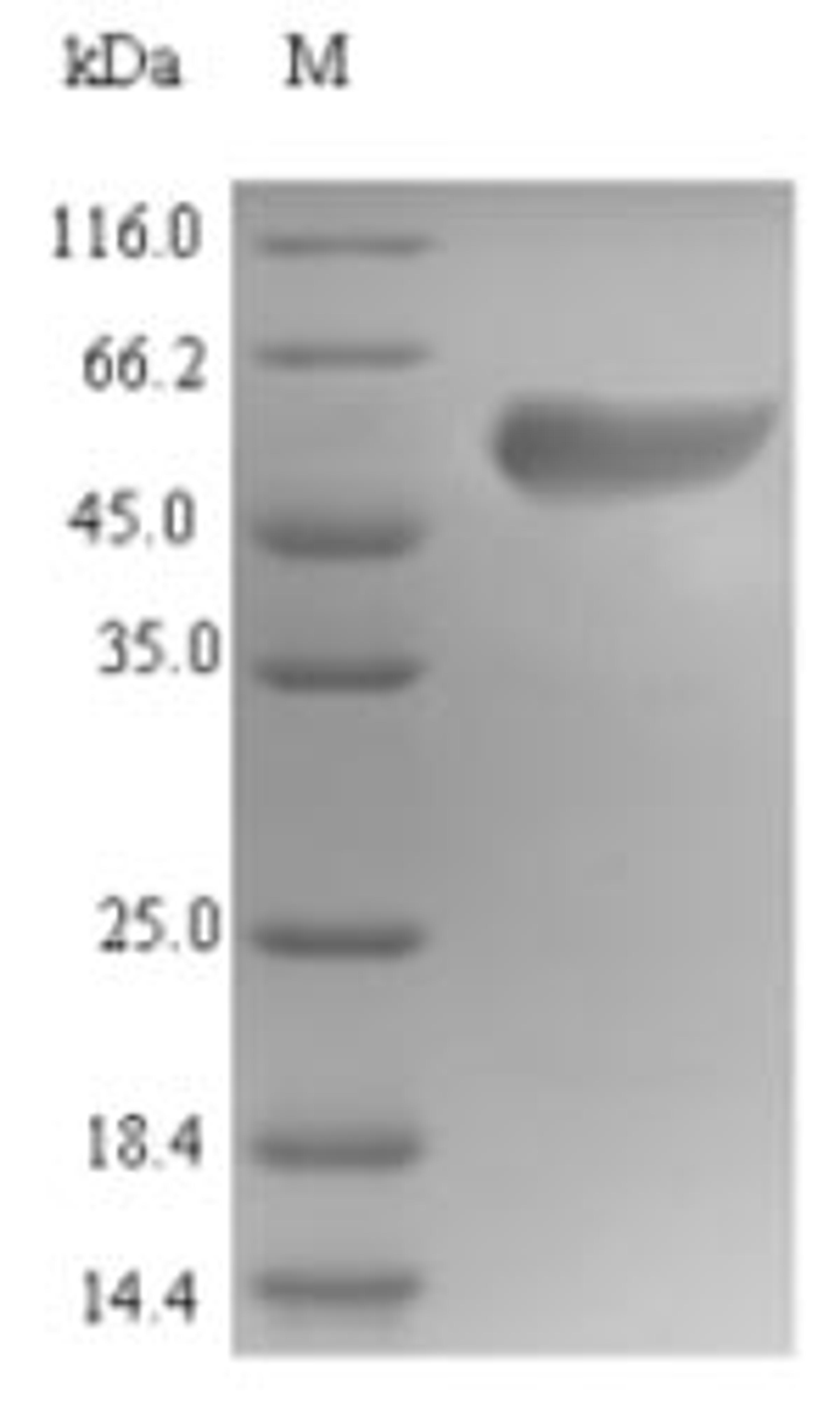 (Tris-Glycine gel) Discontinuous SDS-PAGE (reduced) with 5% enrichment gel and 15% separation gel.