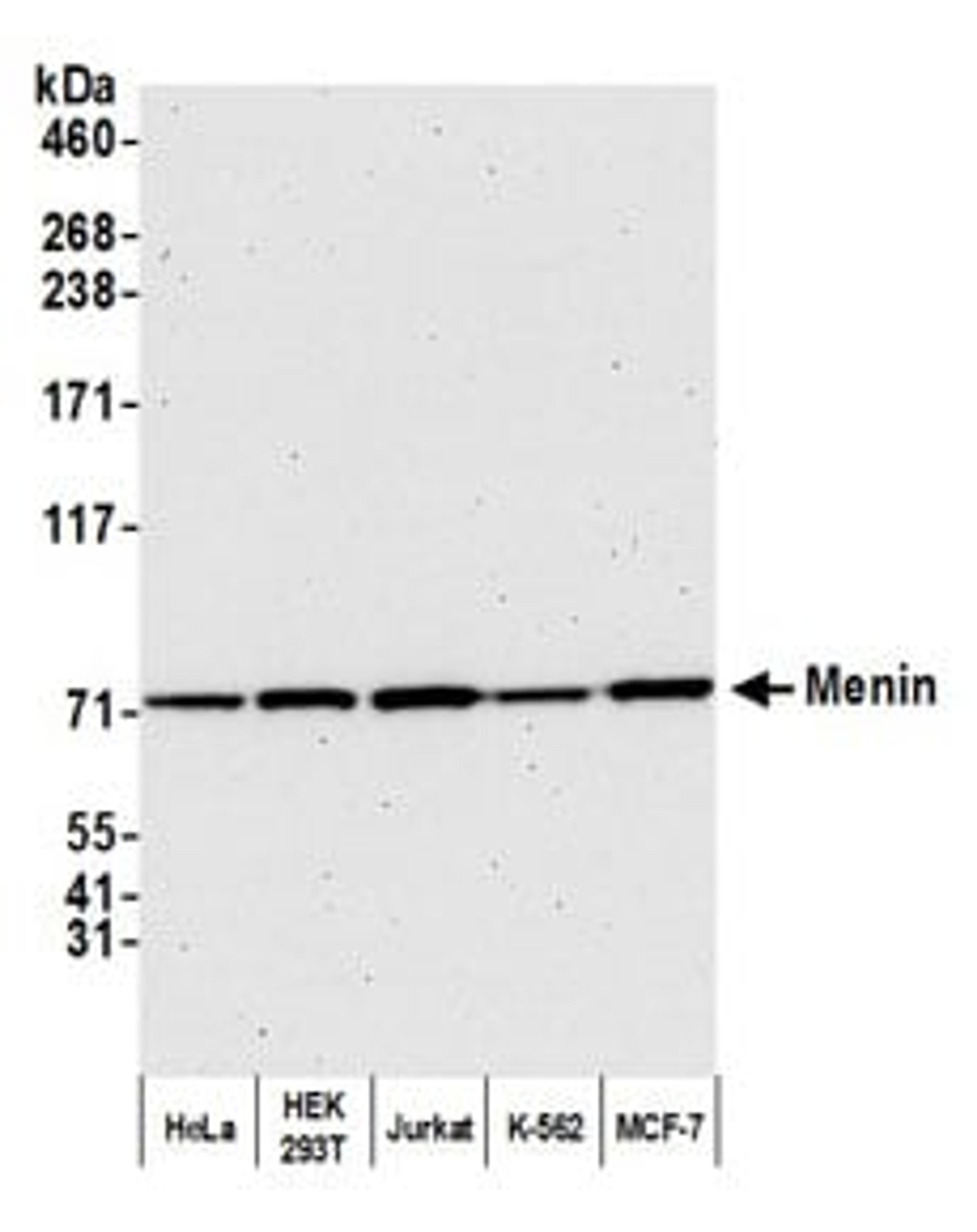 Detection of human Menin by western blot.