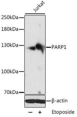 Western blot - PARP1 antibody (A0010)