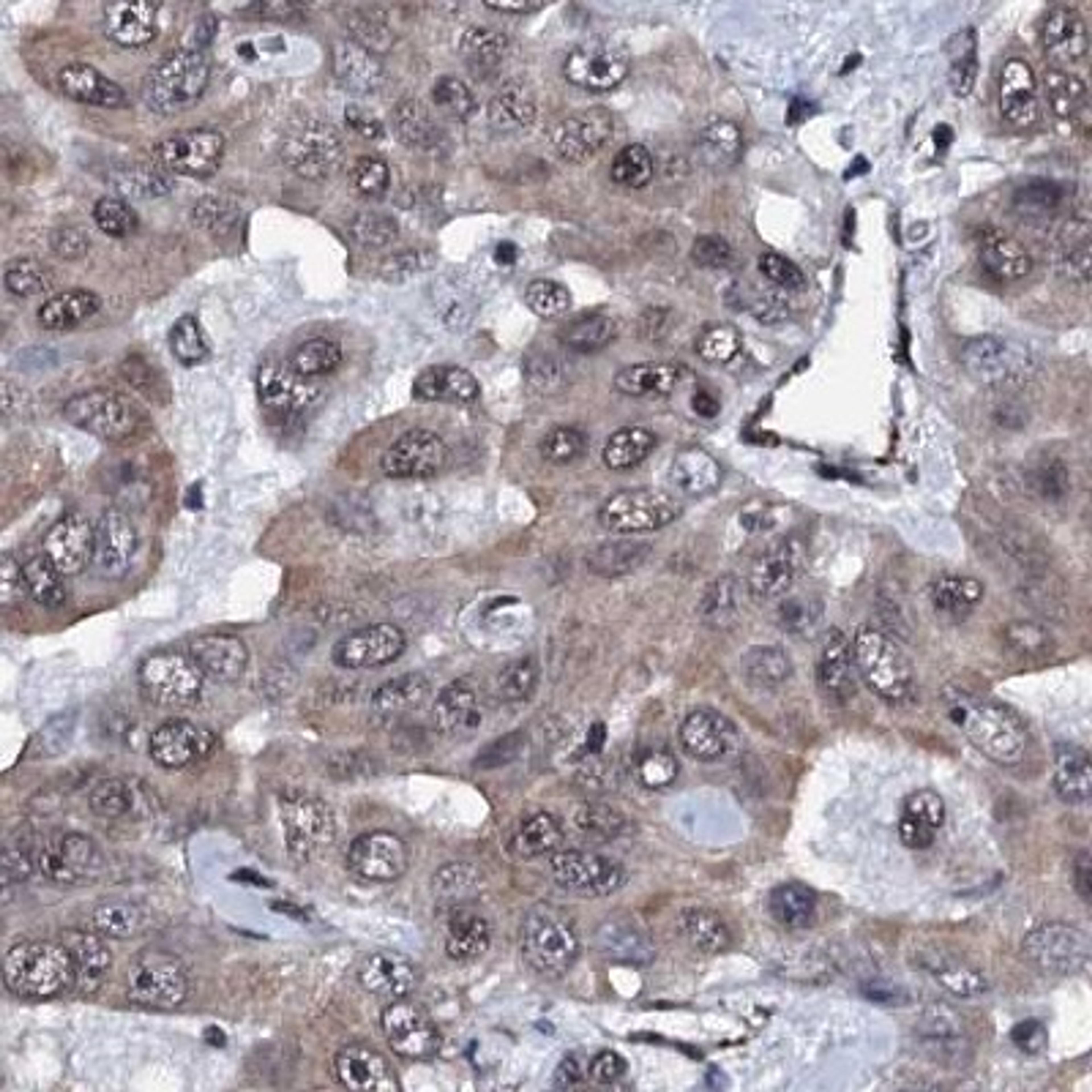 Immunohistochemistry: CWC15 Antibody [NBP2-31977] - Immunohistochemical staining of human thyroid gland shows strong nuclear positivity in glandular cells.