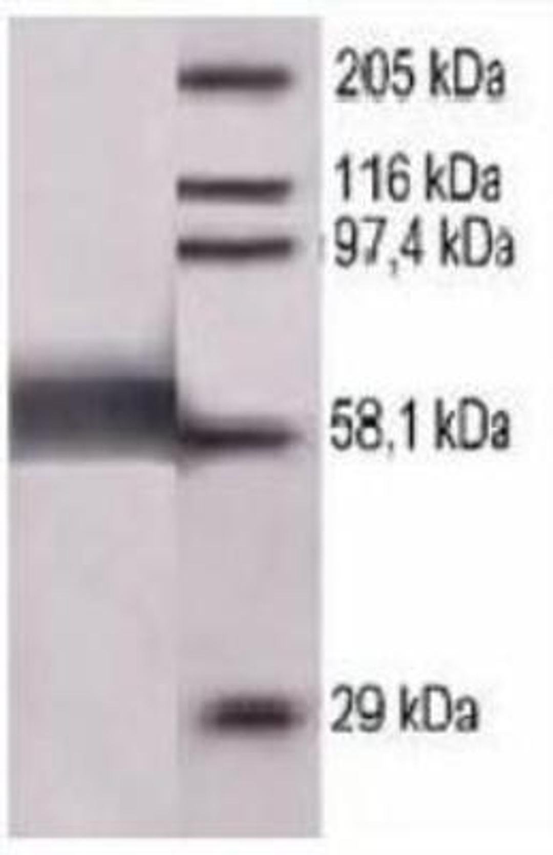 Western Blot: Rubeola (Measles) Nucleoprotein Antibody [NB100-1856] - Recombinant nucleoprotein (1 ug) on 10% SDS-PAGE.