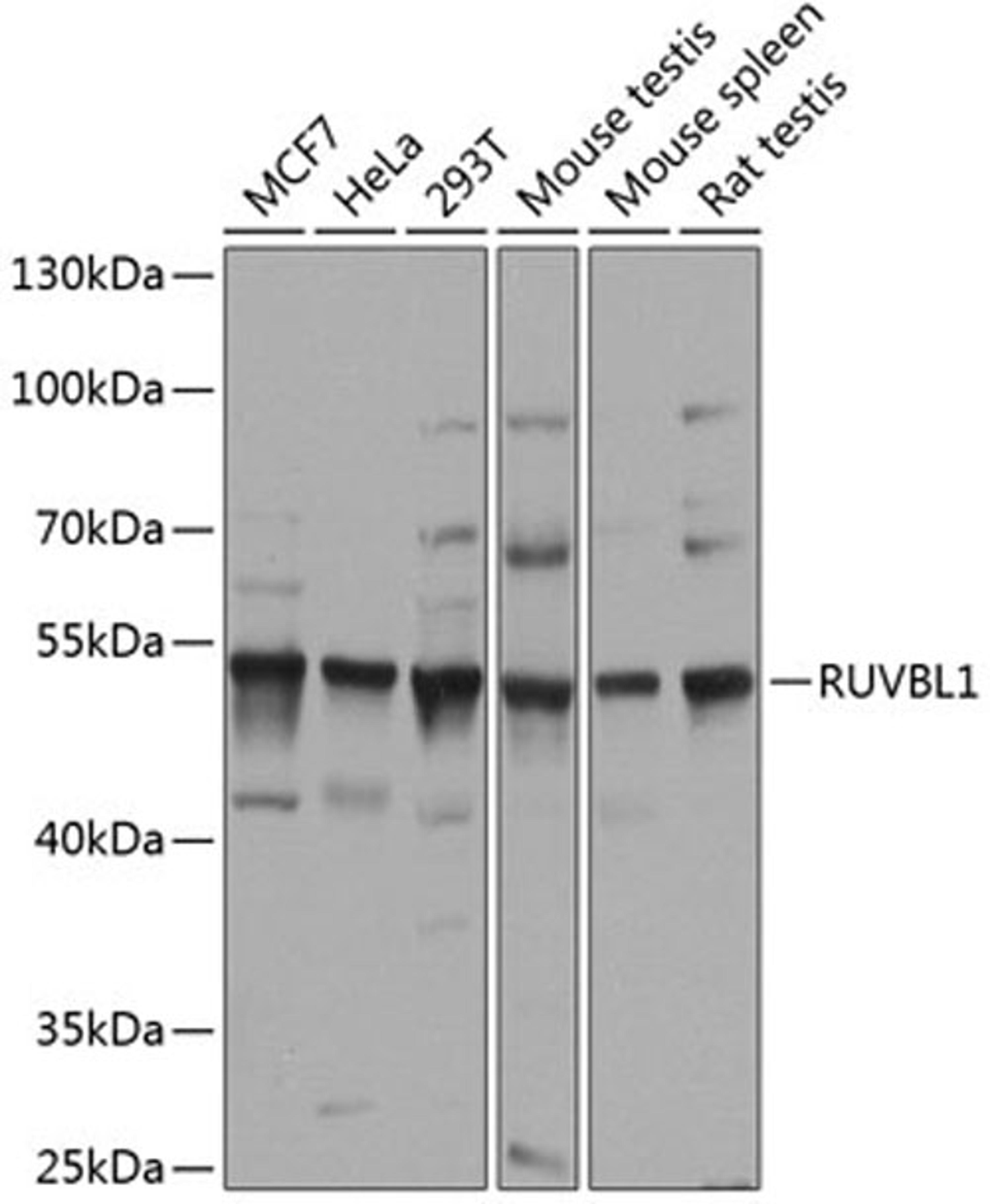 Western blot - RUVBL1 antibody (A14195)