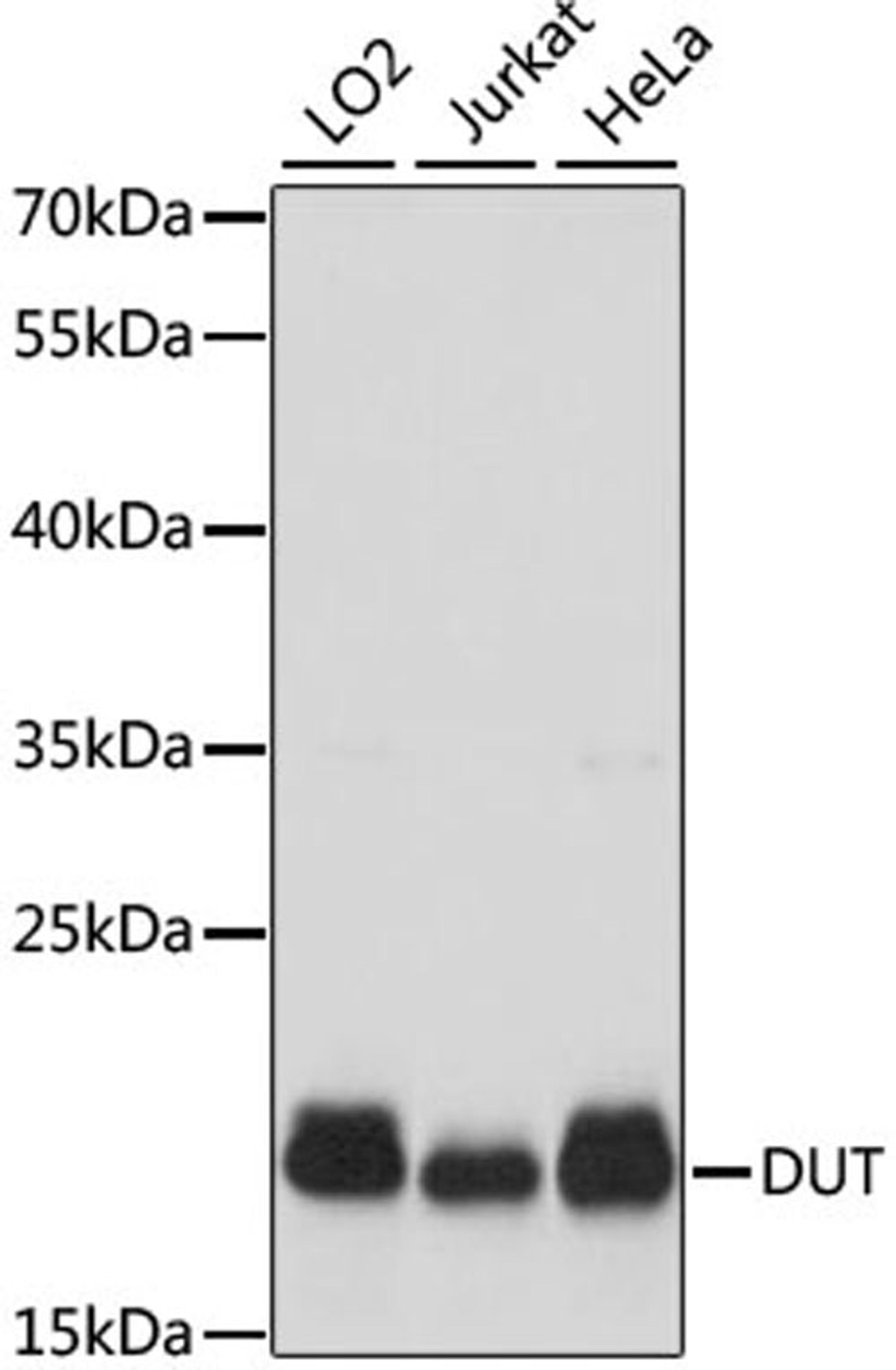 Western blot - DUT antibody (A2901)