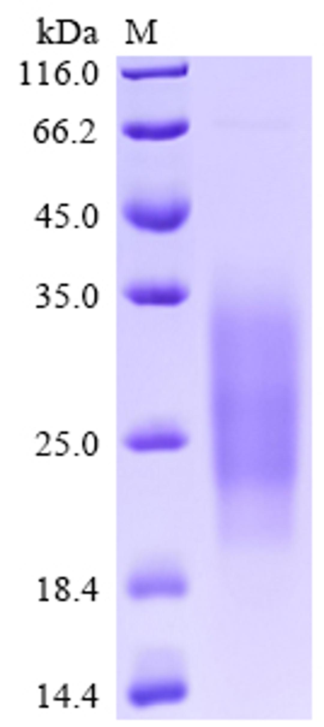 (Tris-Glycine gel) Discontinuous SDS-PAGE (reduced) with 5% enrichment gel and 15% separation gel.