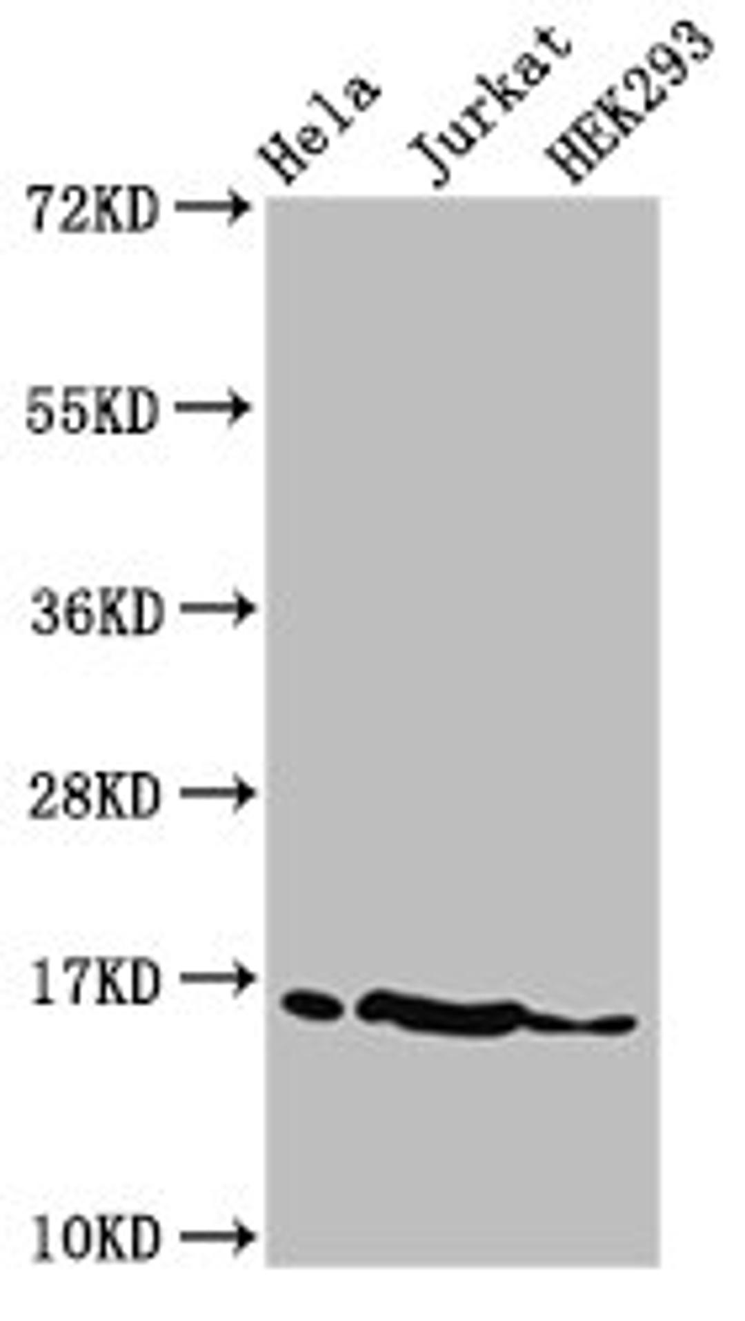 Western Blot. Positive WB detected in: Hela cell acid extracts, Jurkat cell acid extracts, HEK293 cell acid extracts. All lanes: HIST1H3A antibody at 2µg/ml. Secondary. Goat polyclonal to rabbit IgG at 1/50000 dilution. Predicted band size: 16 kDa. Observed band size: 16 kDa