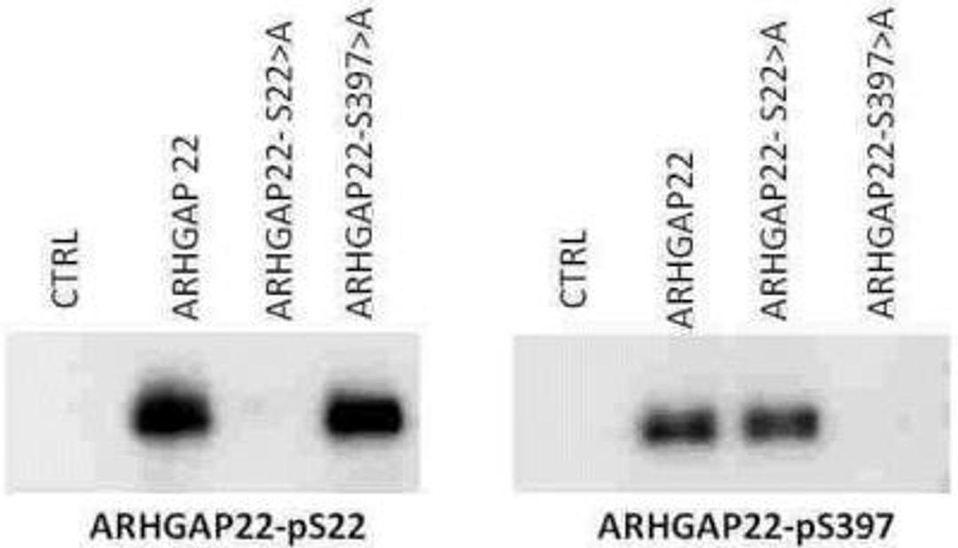 Western Blot: ARHGAP22 [p Ser22] Antibody [NBP1-44072] - ARHGAP22 [Phospo Ser22] Antibody [NBP1-44072] - Protein Molecular weight: 68 kDa  Cell extracts from NIH 3T3cells that were transfected with either a null vector (CTRL), ARHGAP22, ARHGAP22-serine 22 to alanine mutation, ARHGAP22 serine 397 to alanine mutation were electroblotted. The left panel was probed with the NBP1-44072 antibody, while the right panel was probed with the NBP1-44073 antibody, each at 1ug/ml. Each antibody recognizes the unmodified ARHGAP22. NBP1-44072 antibody recognized the S397-A mutation but not the S22-A mutation, while NBP1-44073 antibody recognizes the pS22-A mutation and not the pS397-A mutation. This data confirms the specificity of each ARHGAP22 phospho specific antibody.