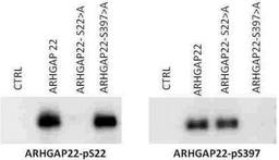 Western Blot: ARHGAP22 [p Ser22] Antibody [NBP1-44072] - ARHGAP22 [Phospo Ser22] Antibody [NBP1-44072] - Protein Molecular weight: 68 kDa  Cell extracts from NIH 3T3cells that were transfected with either a null vector (CTRL), ARHGAP22, ARHGAP22-serine 22 to alanine mutation, ARHGAP22 serine 397 to alanine mutation were electroblotted. The left panel was probed with the NBP1-44072 antibody, while the right panel was probed with the NBP1-44073 antibody, each at 1ug/ml. Each antibody recognizes the unmodified ARHGAP22. NBP1-44072 antibody recognized the S397-A mutation but not the S22-A mutation, while NBP1-44073 antibody recognizes the pS22-A mutation and not the pS397-A mutation. This data confirms the specificity of each ARHGAP22 phospho specific antibody.